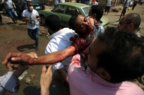 14ago2013---partidarios-do-presidente-deposto-do-egito-mohammed-mursi-carregam-um-homem-ferido-pelas-forcas-de-seguranca-egipcias-no-leste-de-nasr-distrito-da-cidade-do-cairo-1376491672699_1024x675